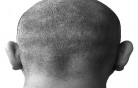 fermare_caduta_capelli fermare_caduta_capelli
