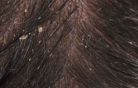 dermatite dermatite
