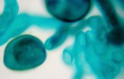 terapia_genica_genetica_capelli terapia_genica_genetica_capelli
