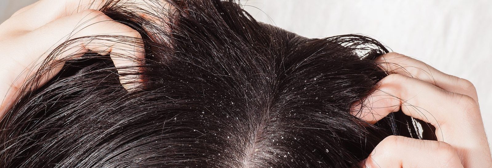 Ciclo del pelo | Prontocapelli