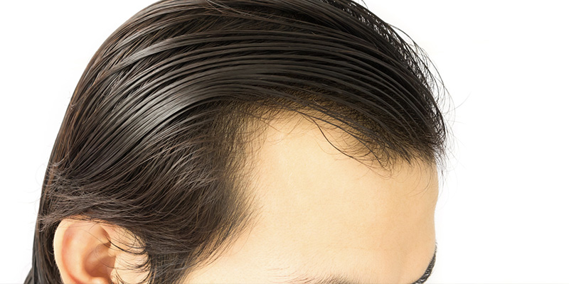 capelli-a-contatto