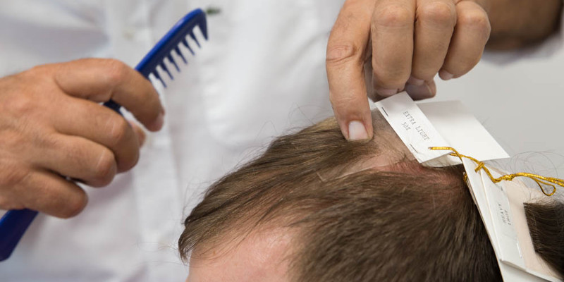 protesi capelli e sudore