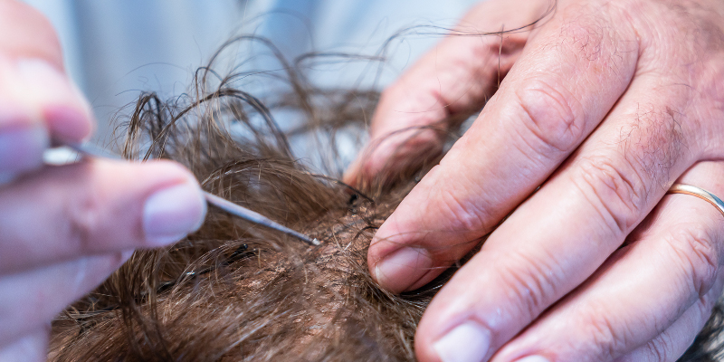 protesi capelli manutenzione