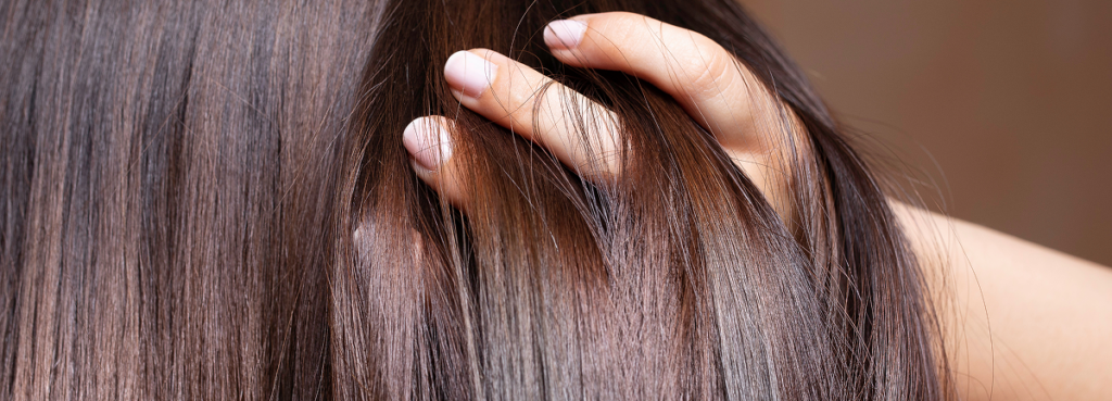 Patch, topper capelli, protesi: impariamo a conoscere i rimedi alla calvizie.